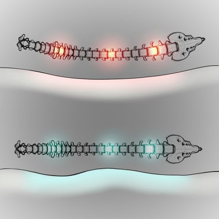 Natural spine alignment can alleviate chronic back pain