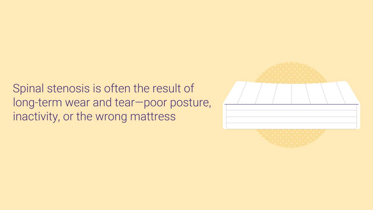Best Mattress for Spinal Stenosis Sleep Junkie